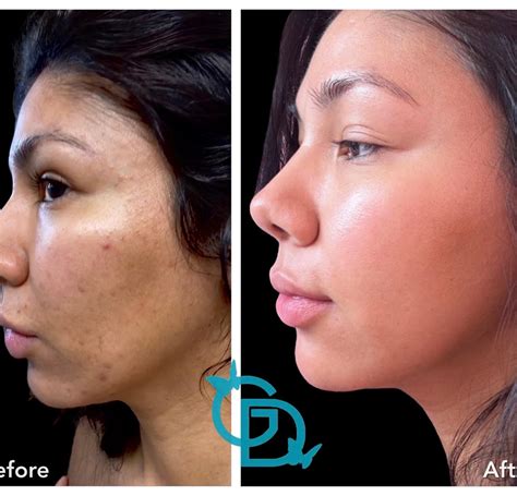 glow dermsolutions|GLOW DERMSOLUTIONS (@glowdermsolutions) .